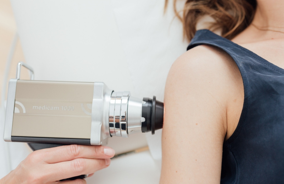 w hautkrebsvorsorge 1