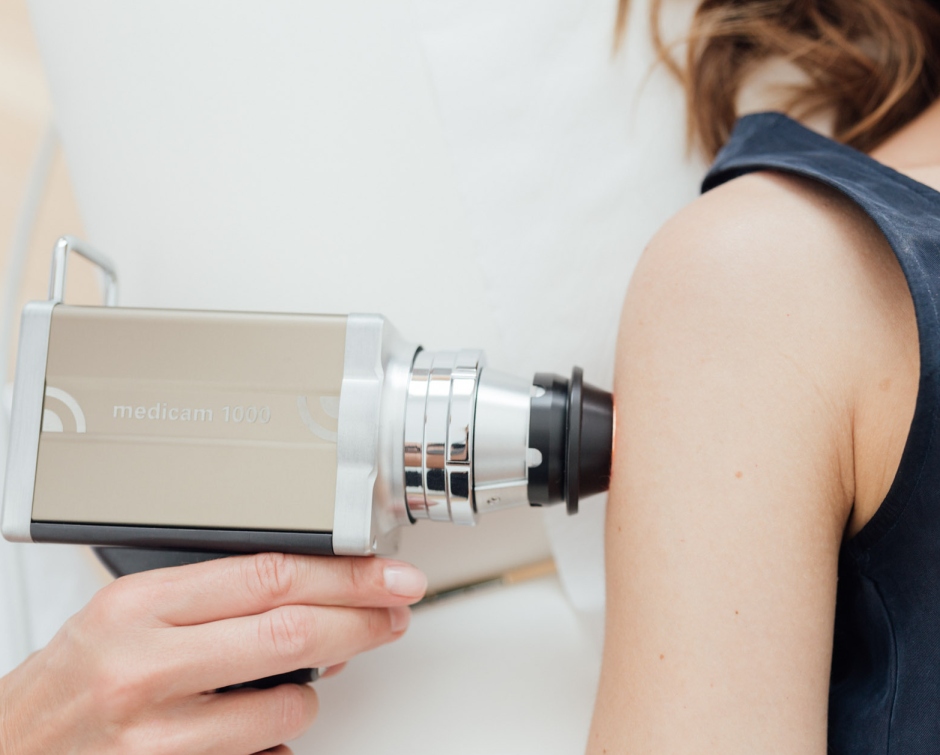 w hautkrebsvorsorge 1