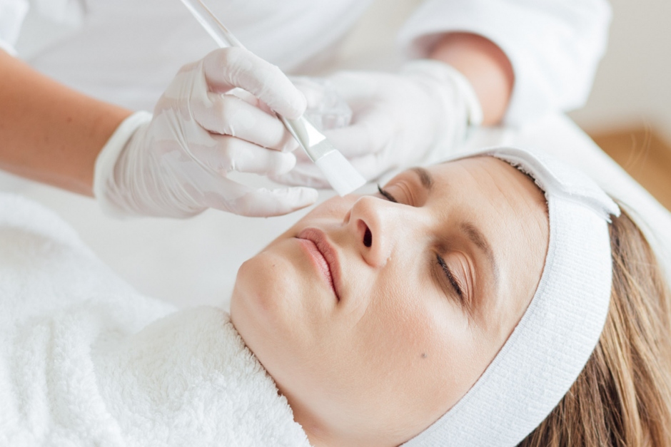 W chemische peelimgs 2