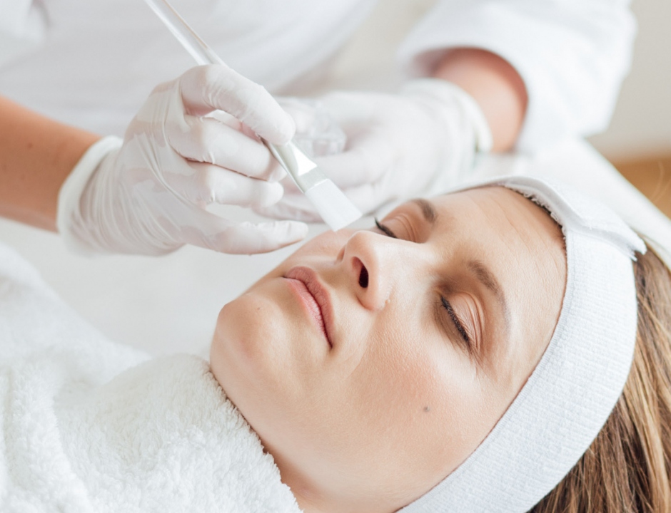 W chemische peelimgs 2