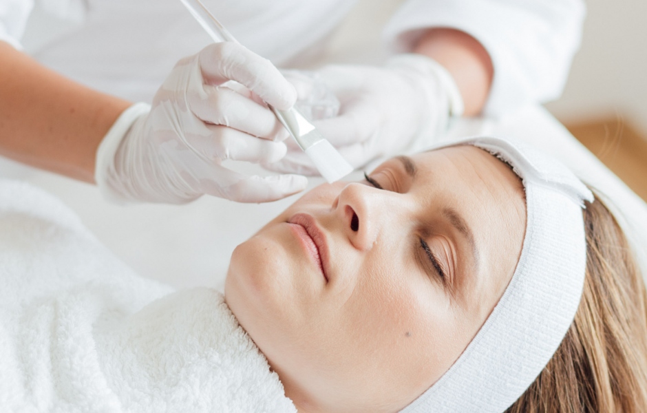 W chemische peelimgs 2