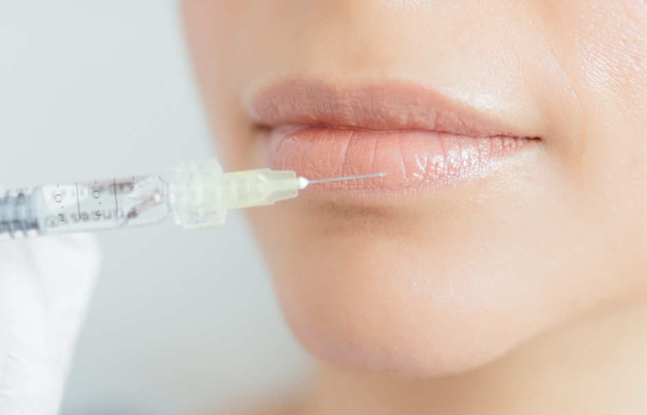 W Hyaluron Lippenunterspritzung 1