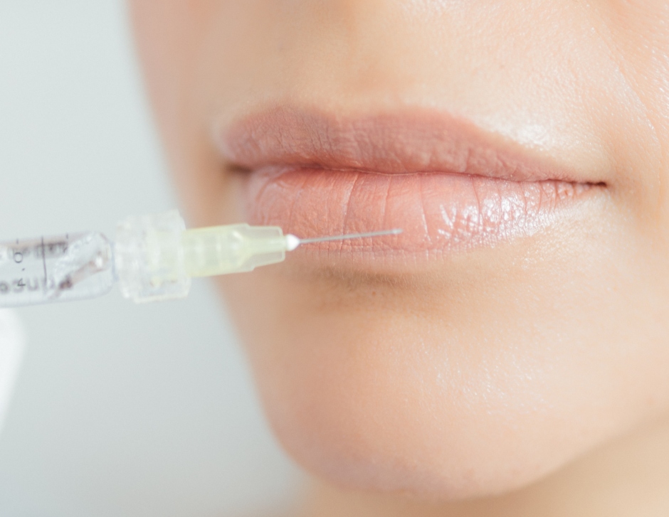 W Hyaluron Lippenunterspritzung 1