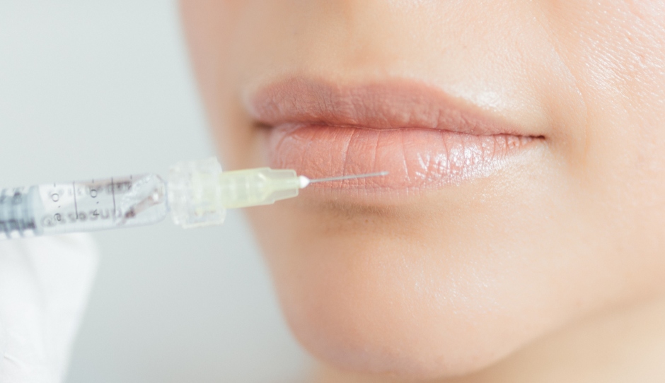 W Hyaluron Lippenunterspritzung 1